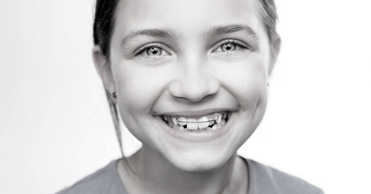 Early Period Orthodontics