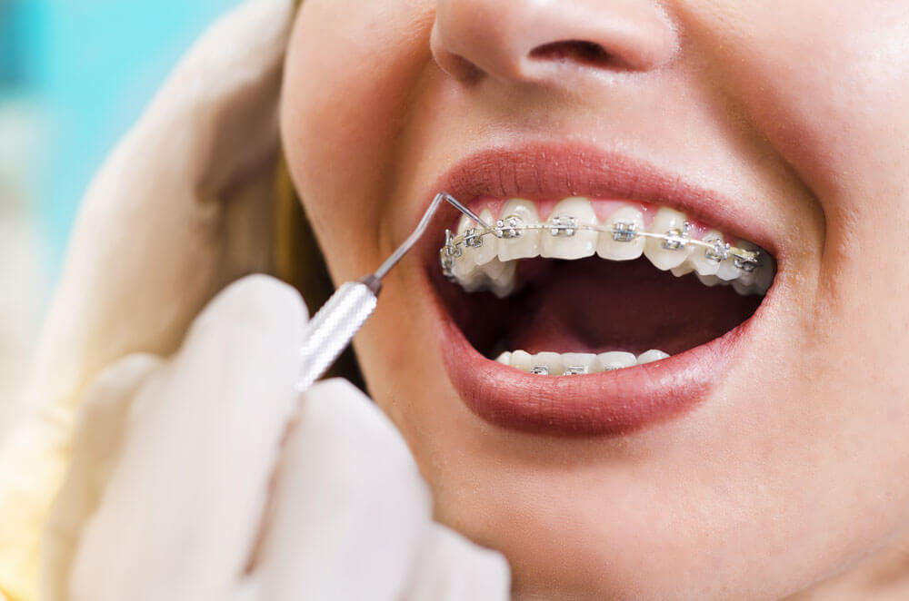 Causes of Orthodontic Problems