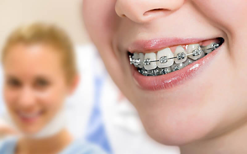 Ortodontik Tedaviden Sonrası