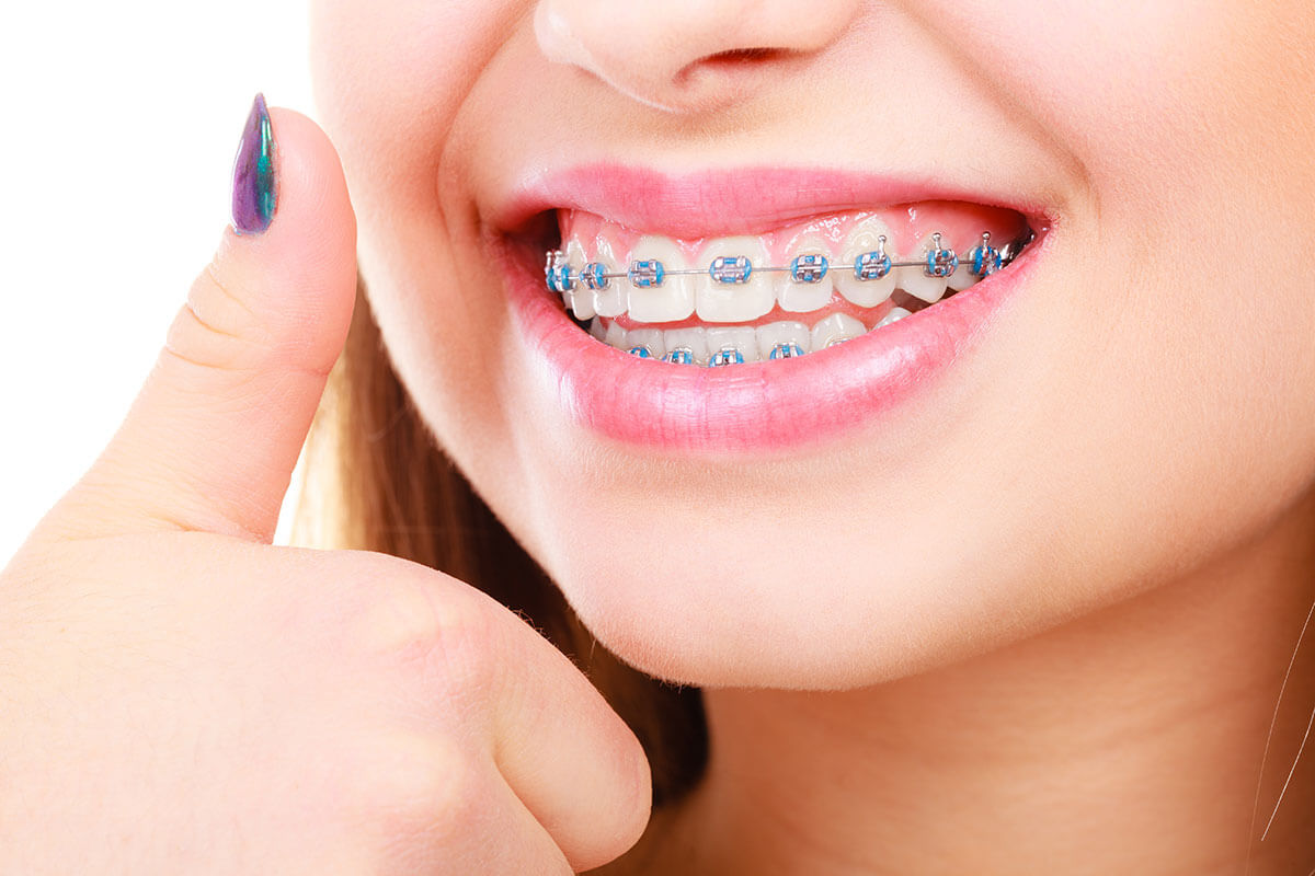 Things to Consider in Orthodontic Treatment