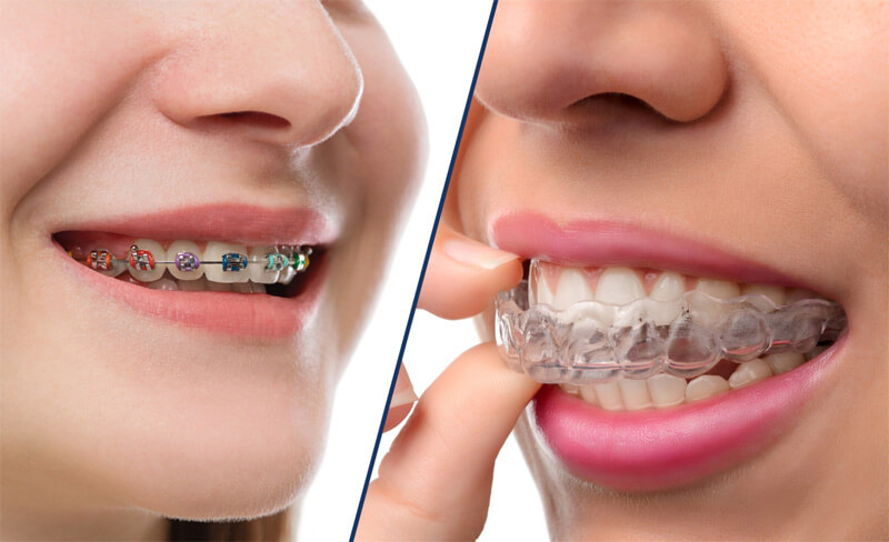 When Should Orthodontic Treatment Start?